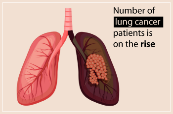 Massive increase in country's lung cancer burden
