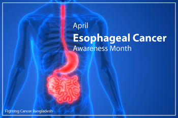 April: Esophageal Cancer Awareness Month Being Observed