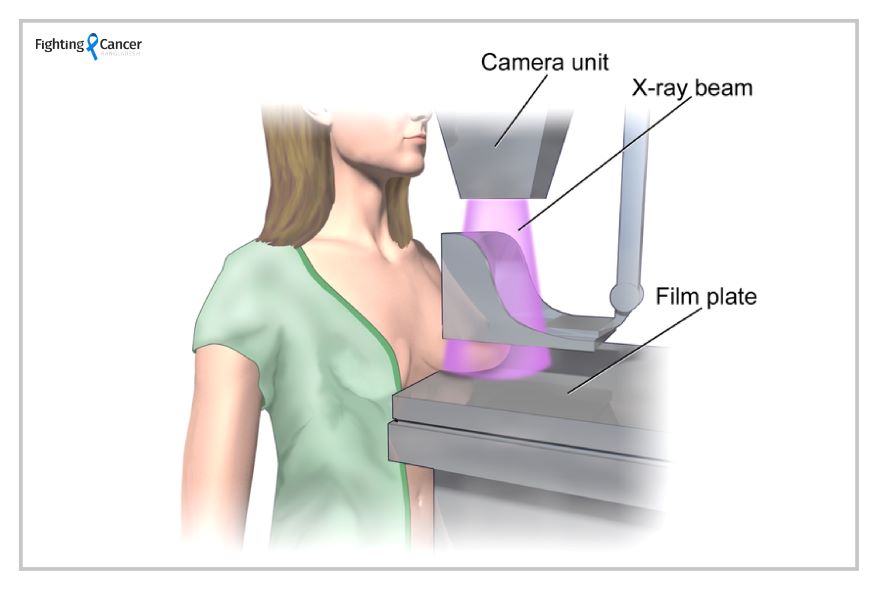 Why would you need to undergo a mammography?