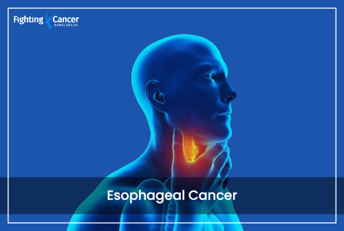 Esophageal Cancer