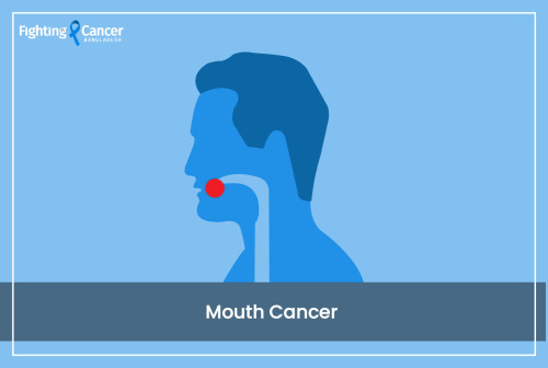 Mouth Cancer
