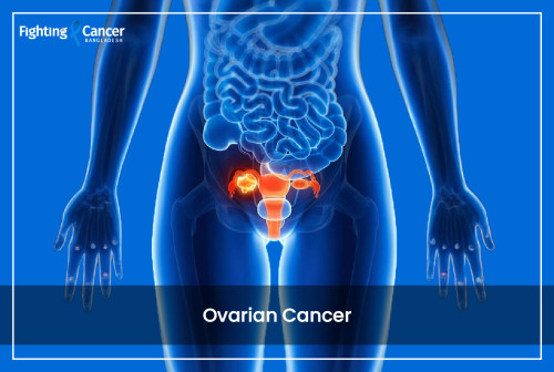 Ovarian Cancer