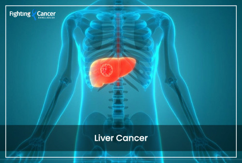 Liver Cancer