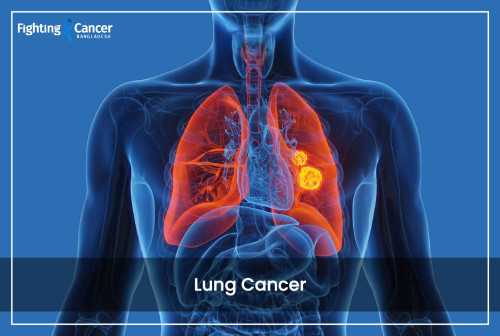 Lung Cancer
