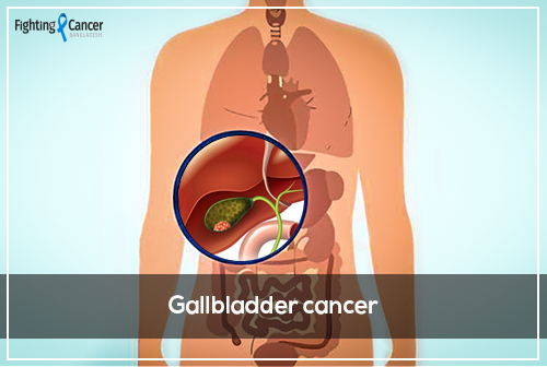 Gallbladder cancer
