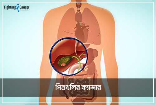 পিত্তথলির ক্যান্সার